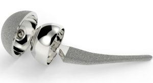Advancing Orthopedic Implant Manufacturing